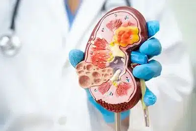 Kidney Disease – 360 Chronic Care Management